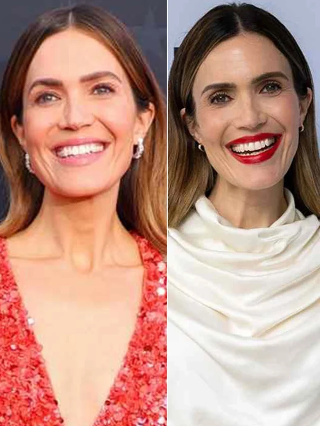 Mandy Moore’s Extraordinary Red Carpet Transformation Wows Fans Mandy Moore’s Extraordinary Red Carpet Transformation Wows Fans
